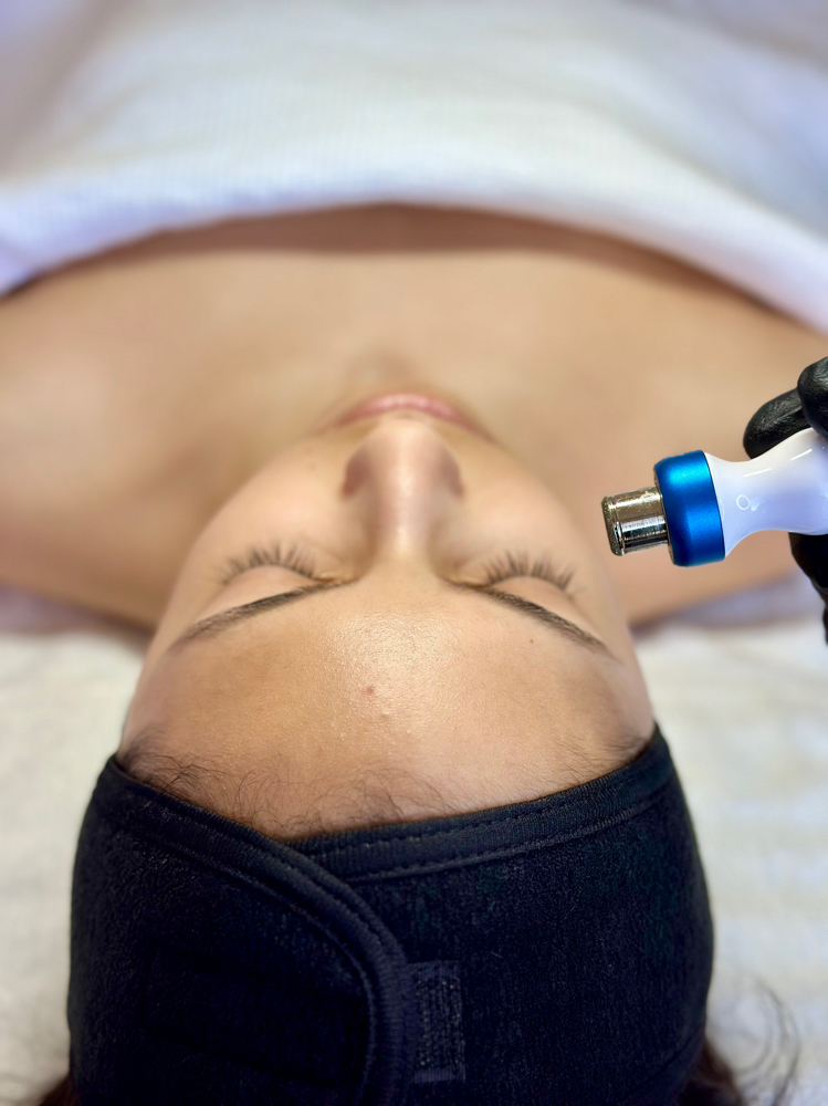 Microdermabrasion