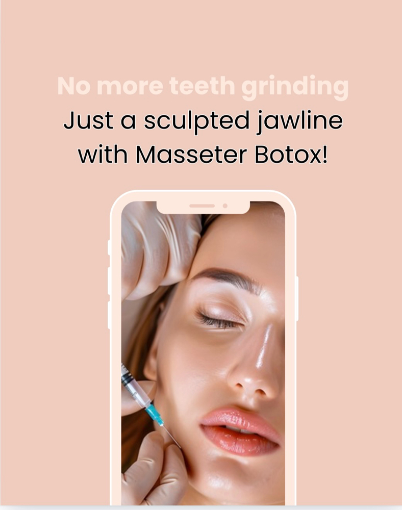 Botox Masseter 40 Units
