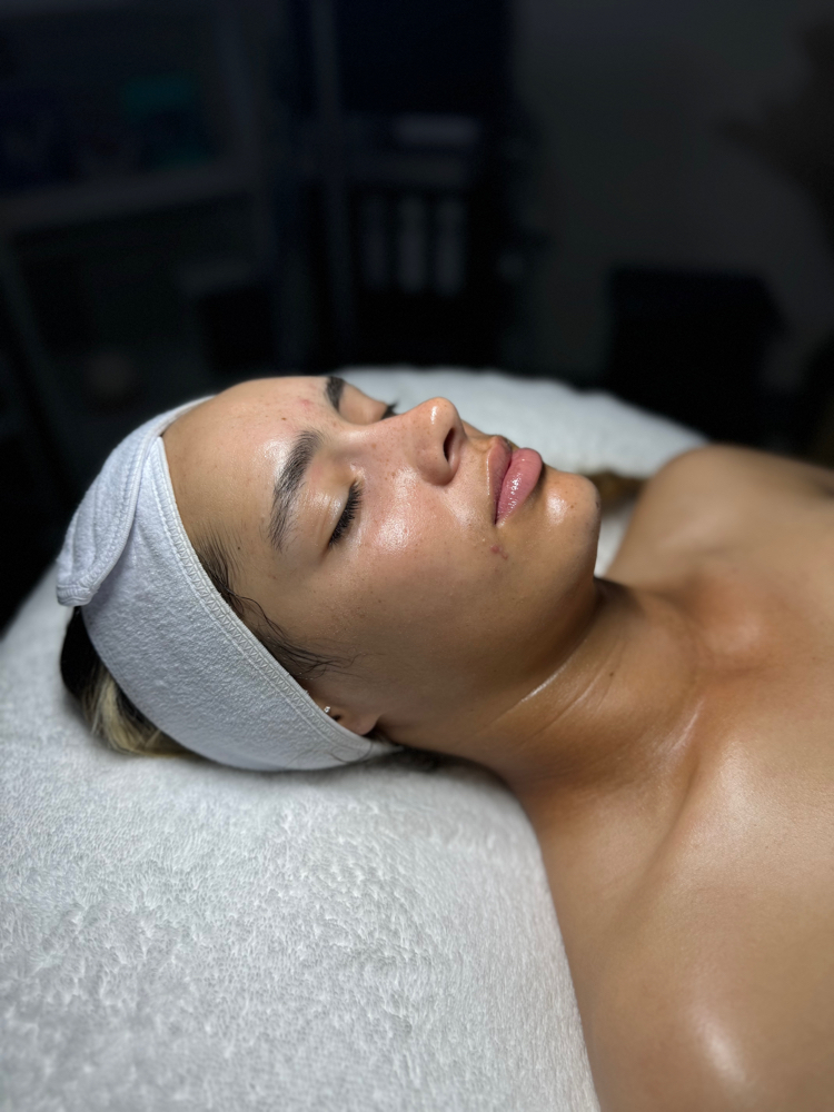 Anti Aging chemical peel
