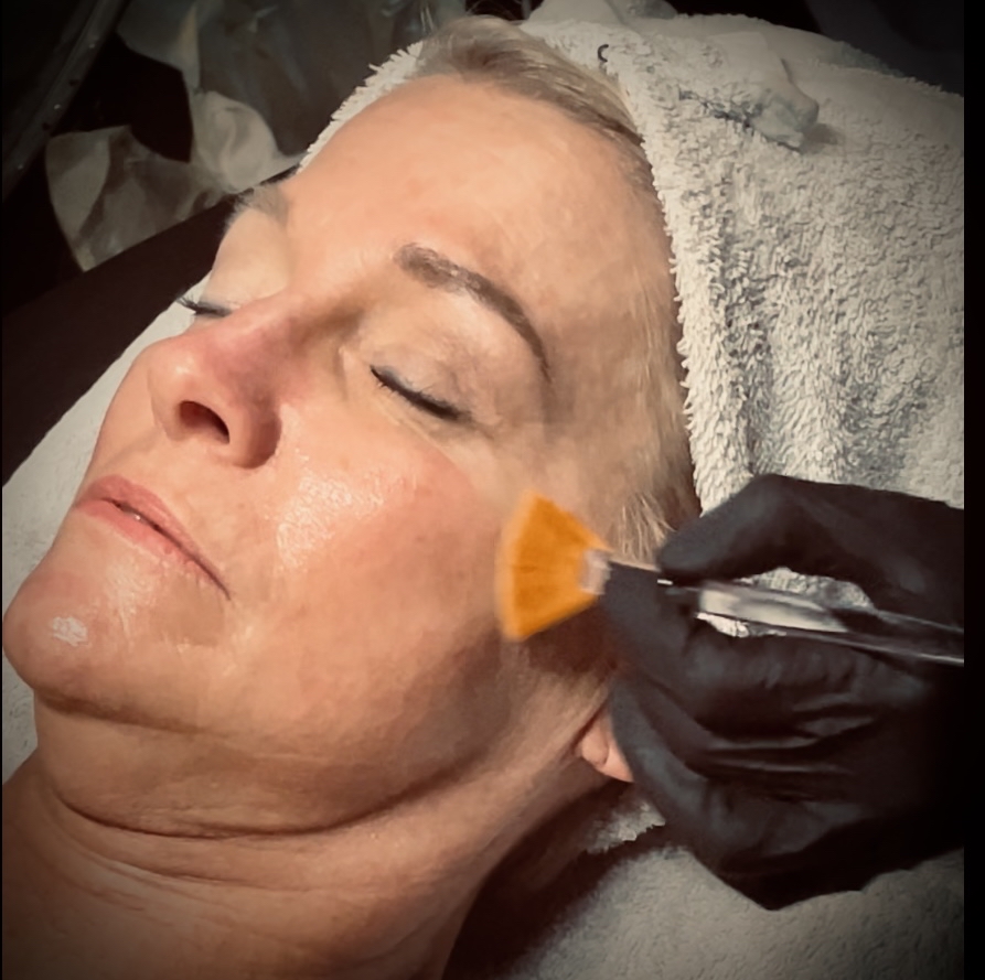 Dermaplane Facial