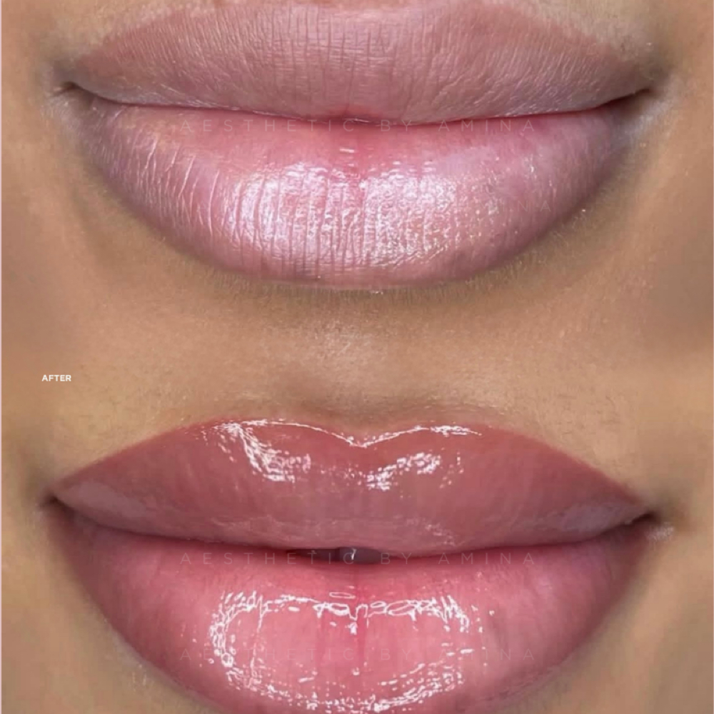 Lip Blush at Aesthetics by Amina in New York, NY