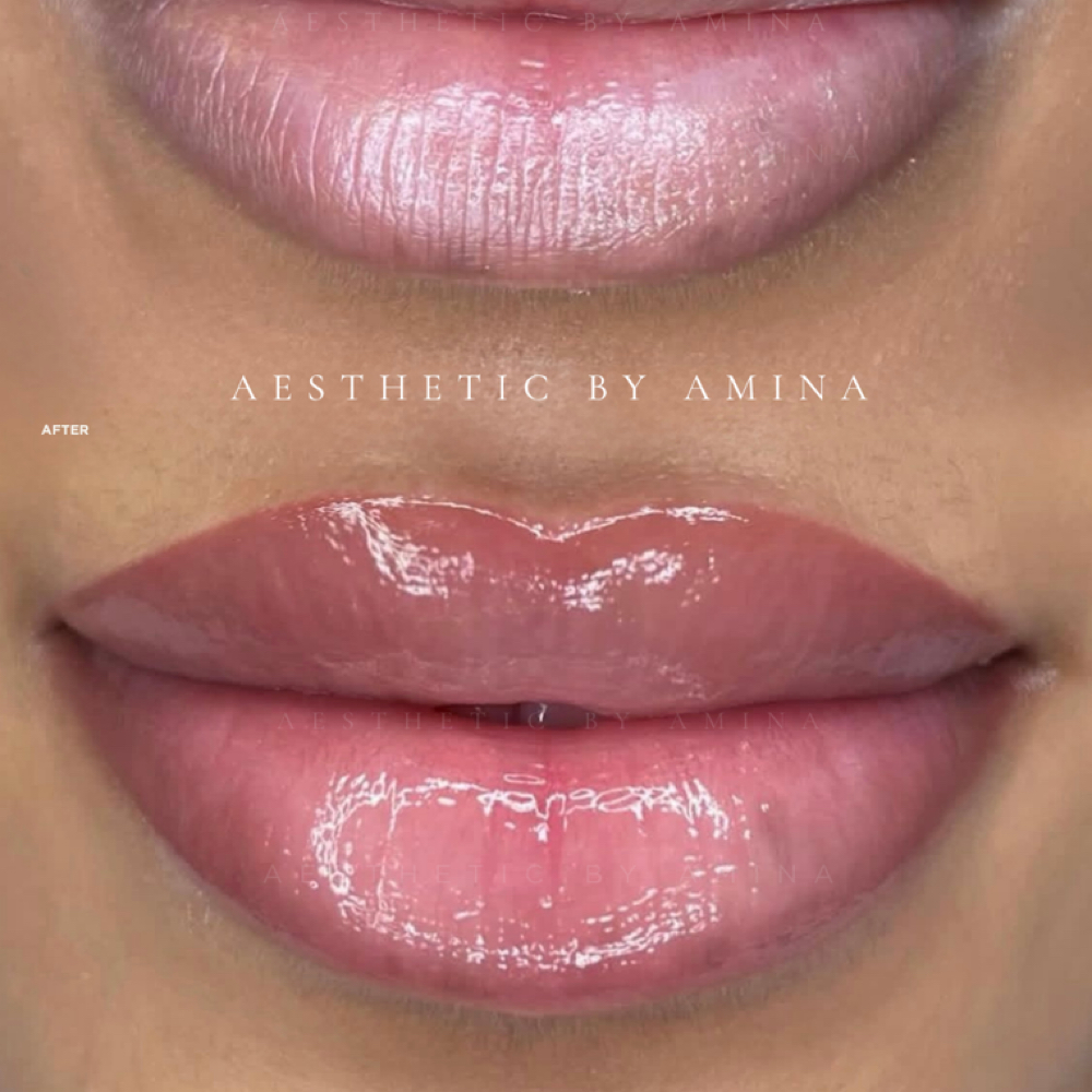 Lip Blush at Aesthetics by Amina in New York, NY