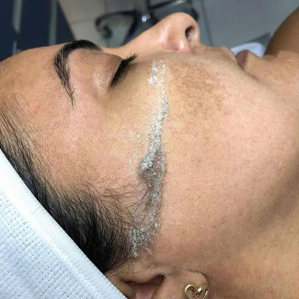 Dermaplaning at ARRIS BEAUTY in McDonough, GA