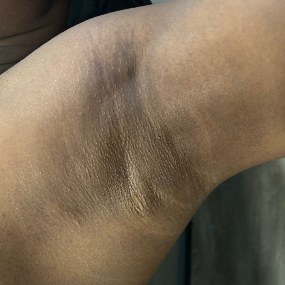 Underarm Wax at ASlaybyShaye Beauty & Wellness LLC in Kansas City, MO