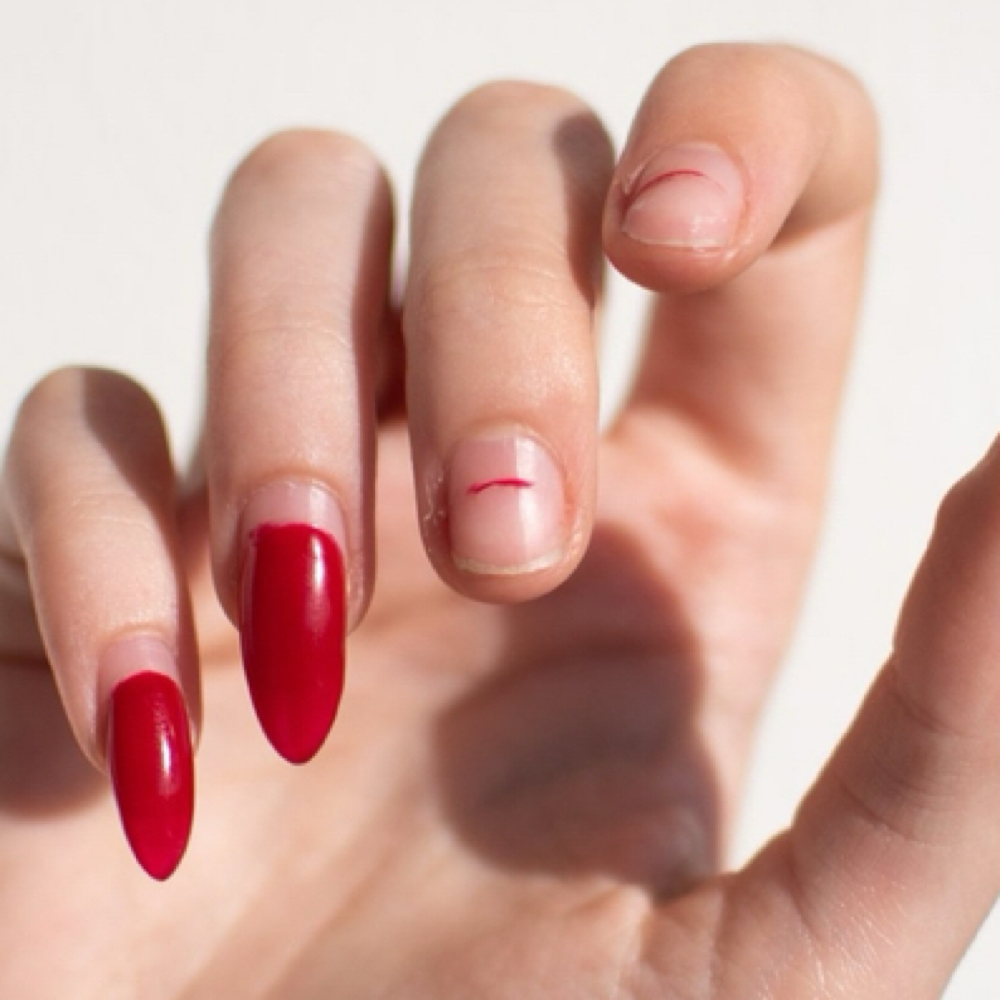 Nail Repair at LynnXStudio in Niles, OH
