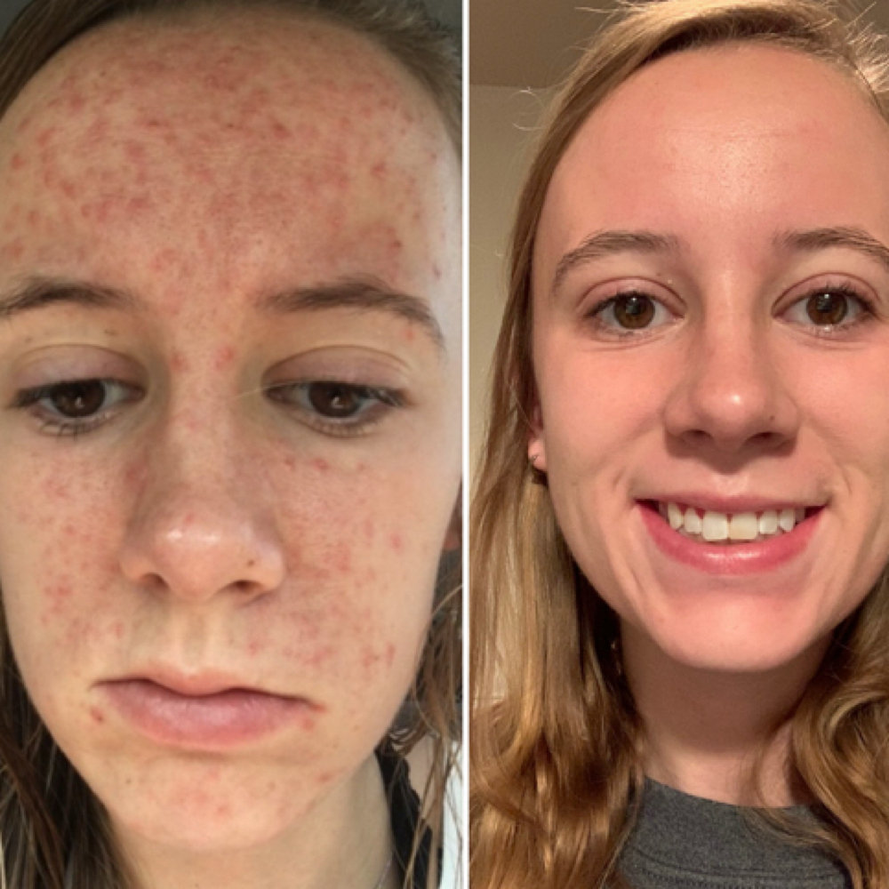 The Glow Method at Berry Luxe Esthetics in Abilene, TX