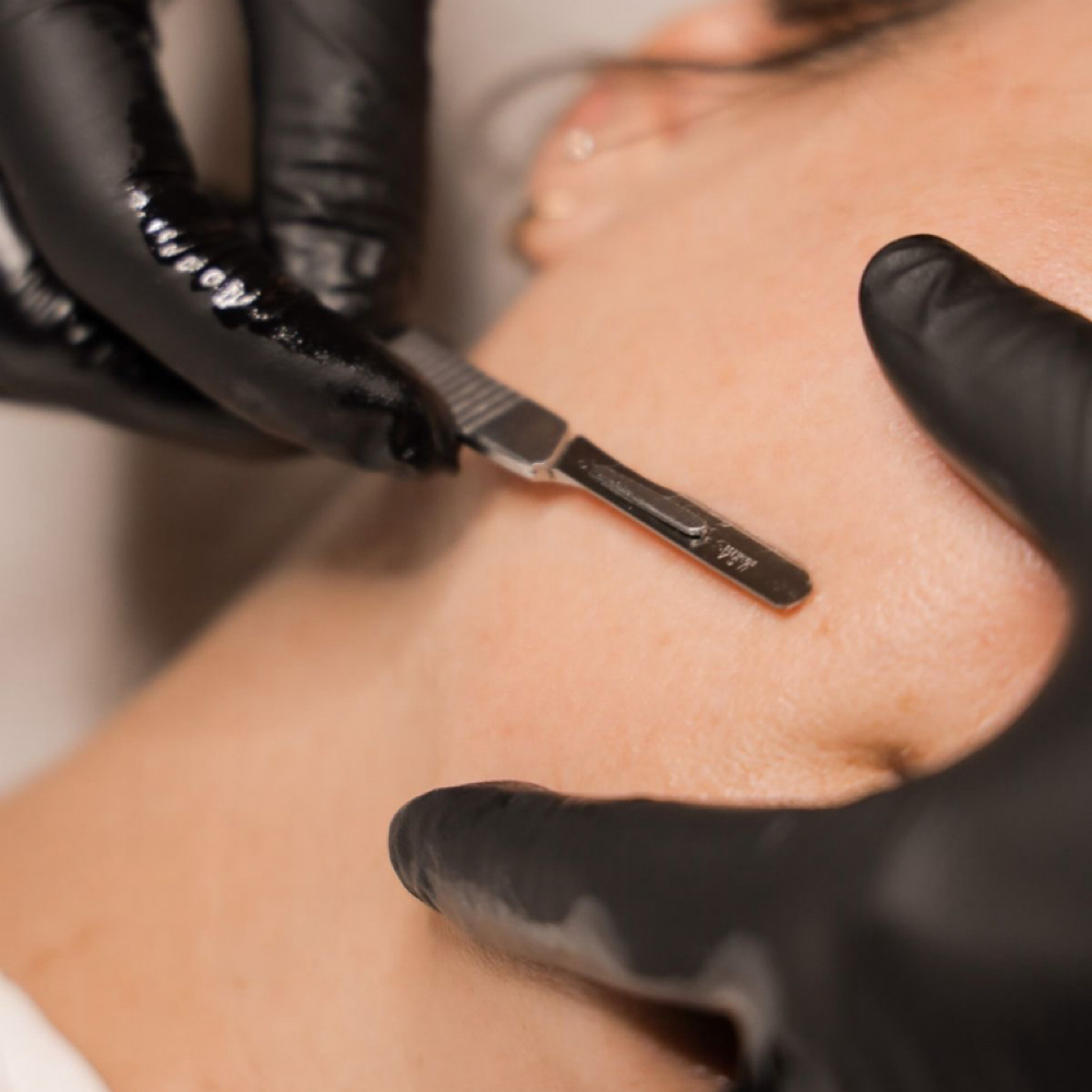 Express Dermaplane at Fae Esthetics in Raleigh, NC