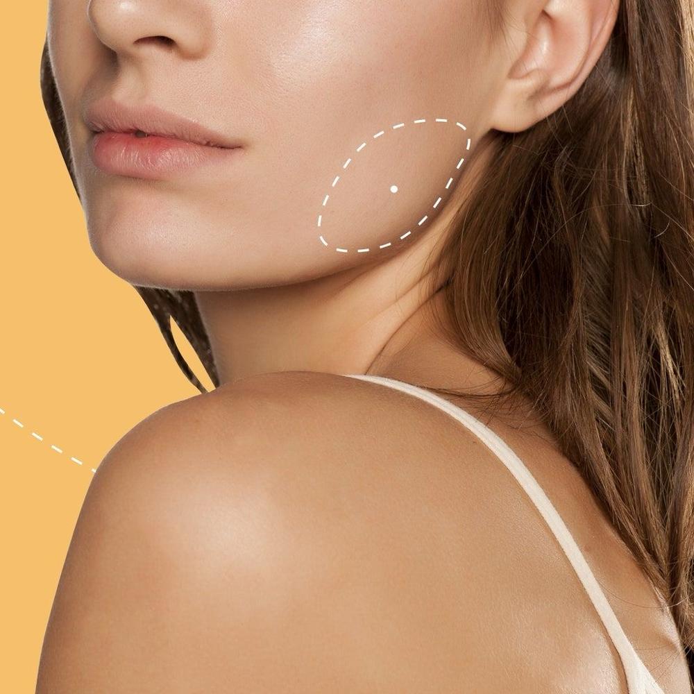 “Masseter” Mandibular Botox