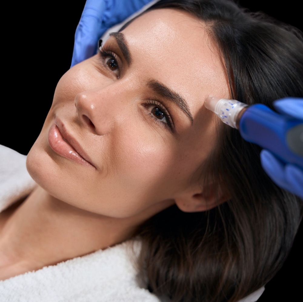 Microneedling