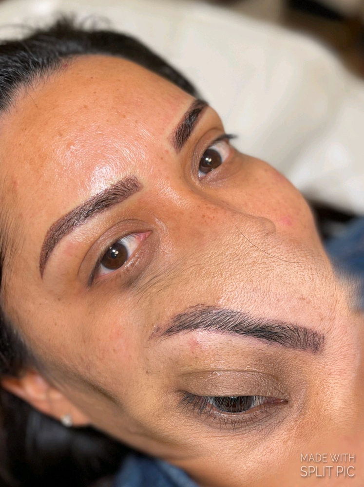 Brow Correction Consultation