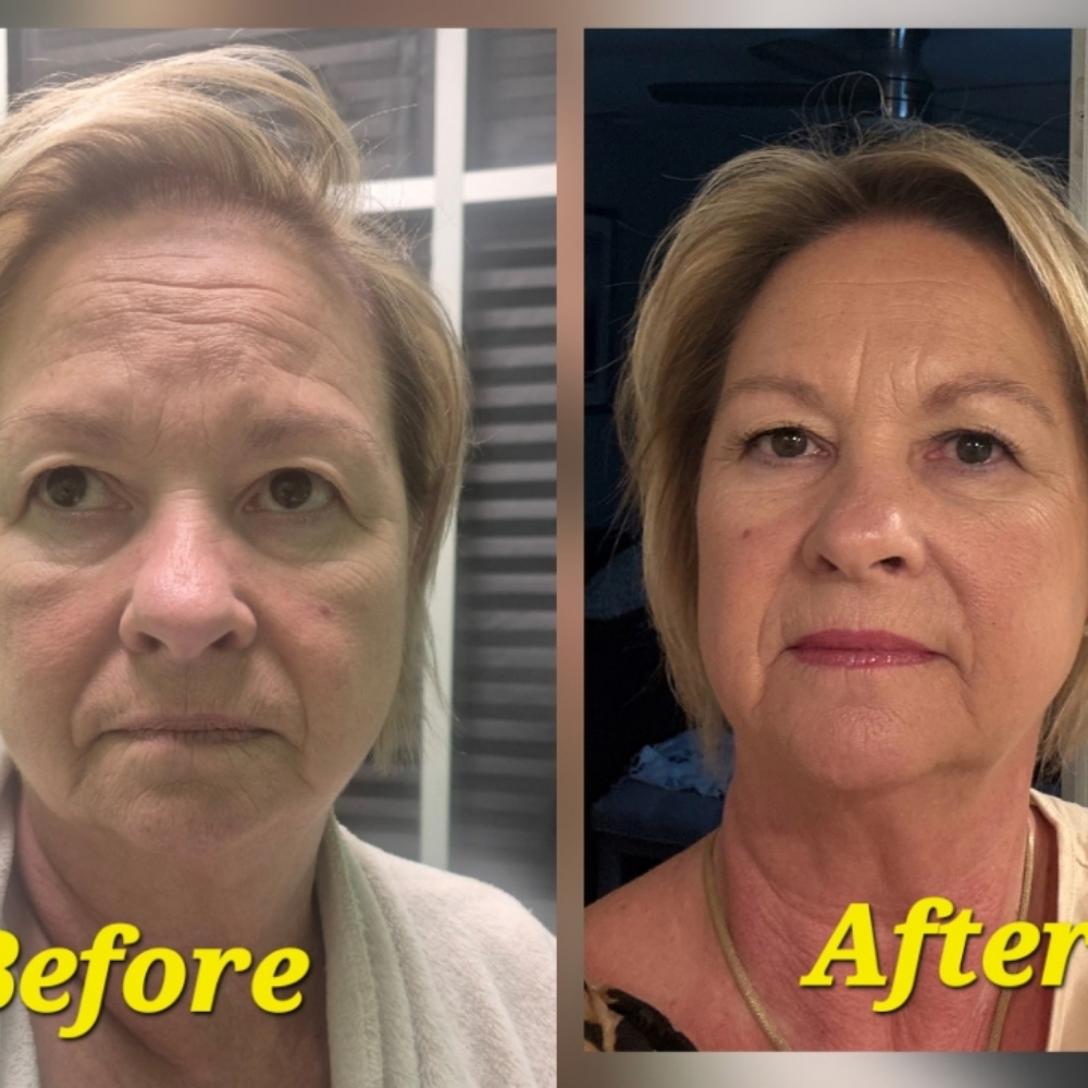 Turn back the hands Facial at JUST BEAUTIFUL SKIN in Goose Creek, SC