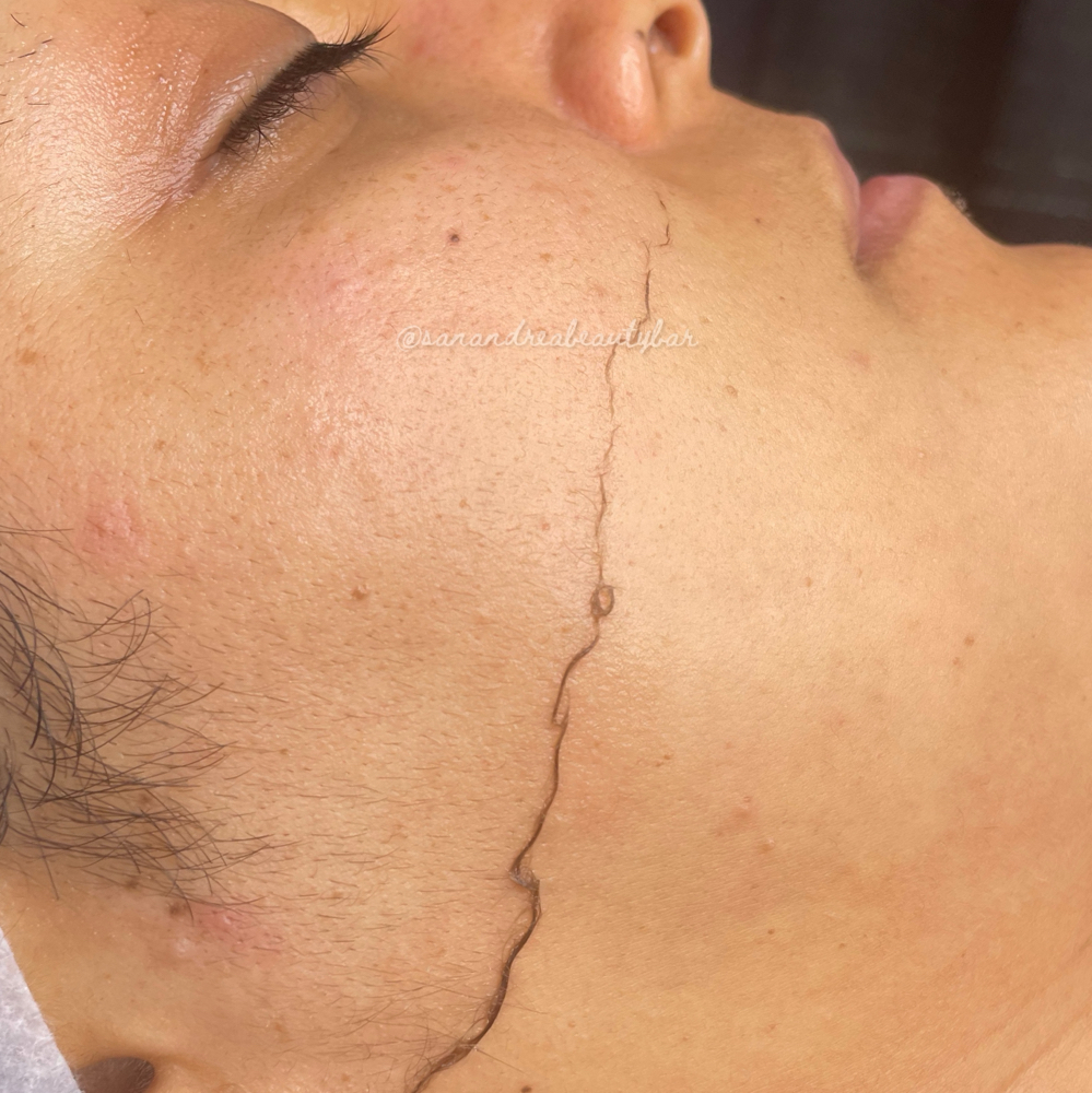 Express Dermaplaning