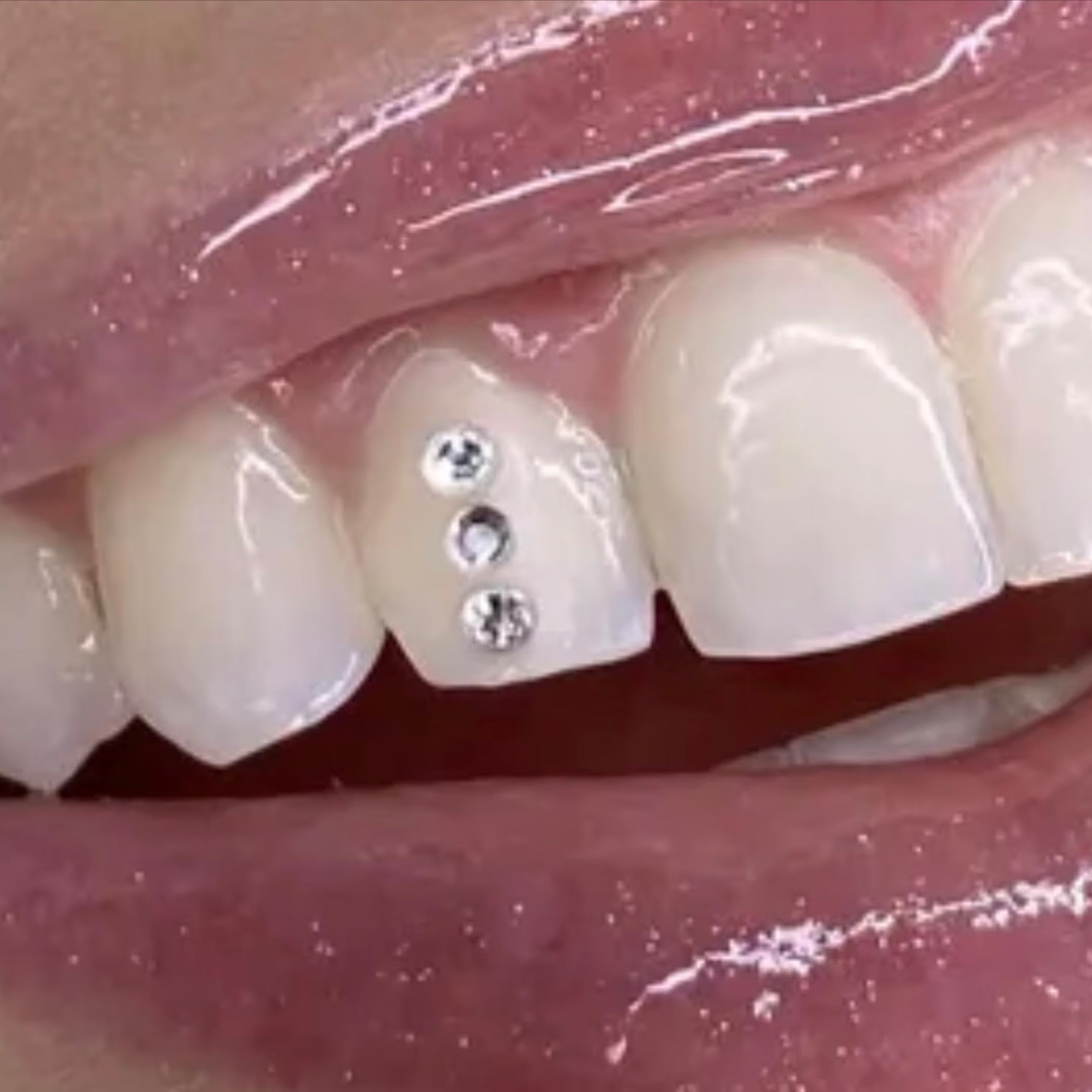 Tooth Gems - Triple at Rise Beauty Studio in Forest Grove, OR