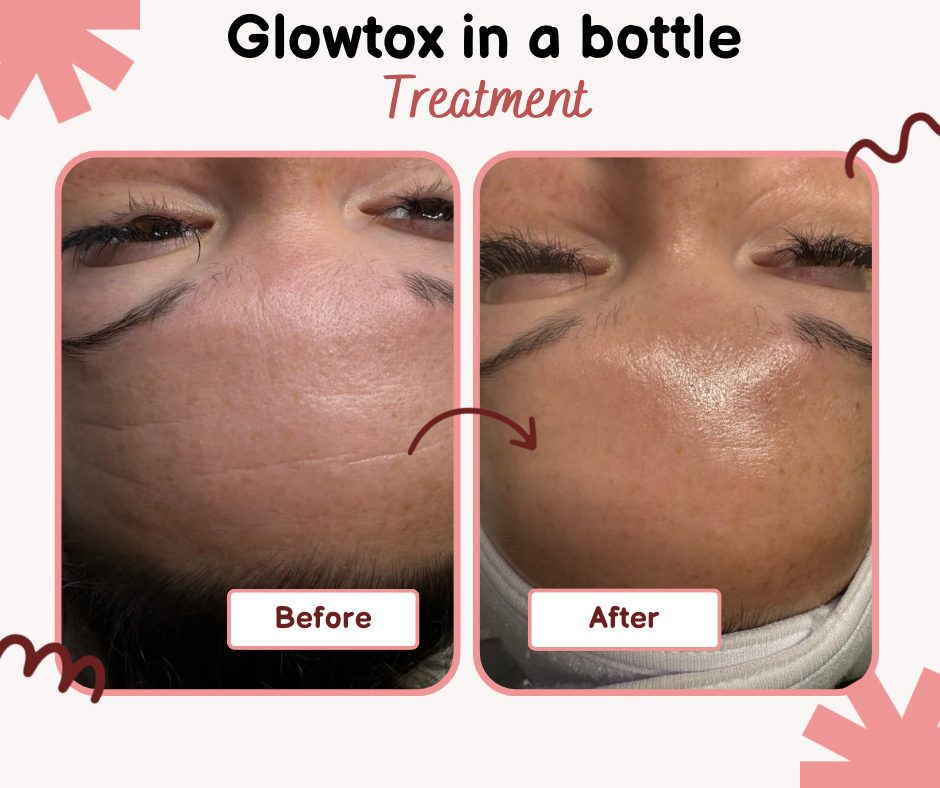 Glowtox In A Bottle (Series 3)