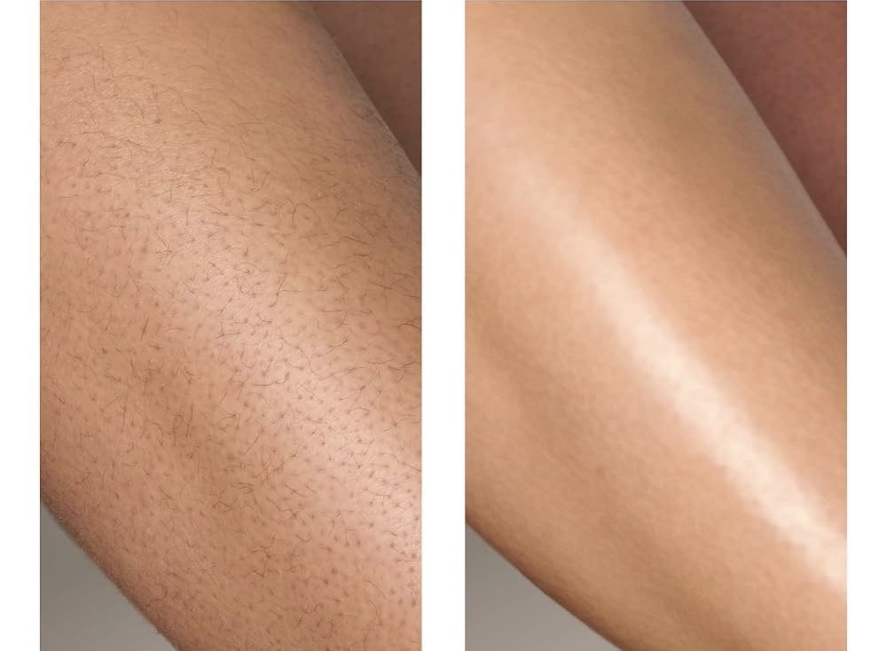 Upper Leg Wax at Bella Donna Esthetics in Beaufort, SC