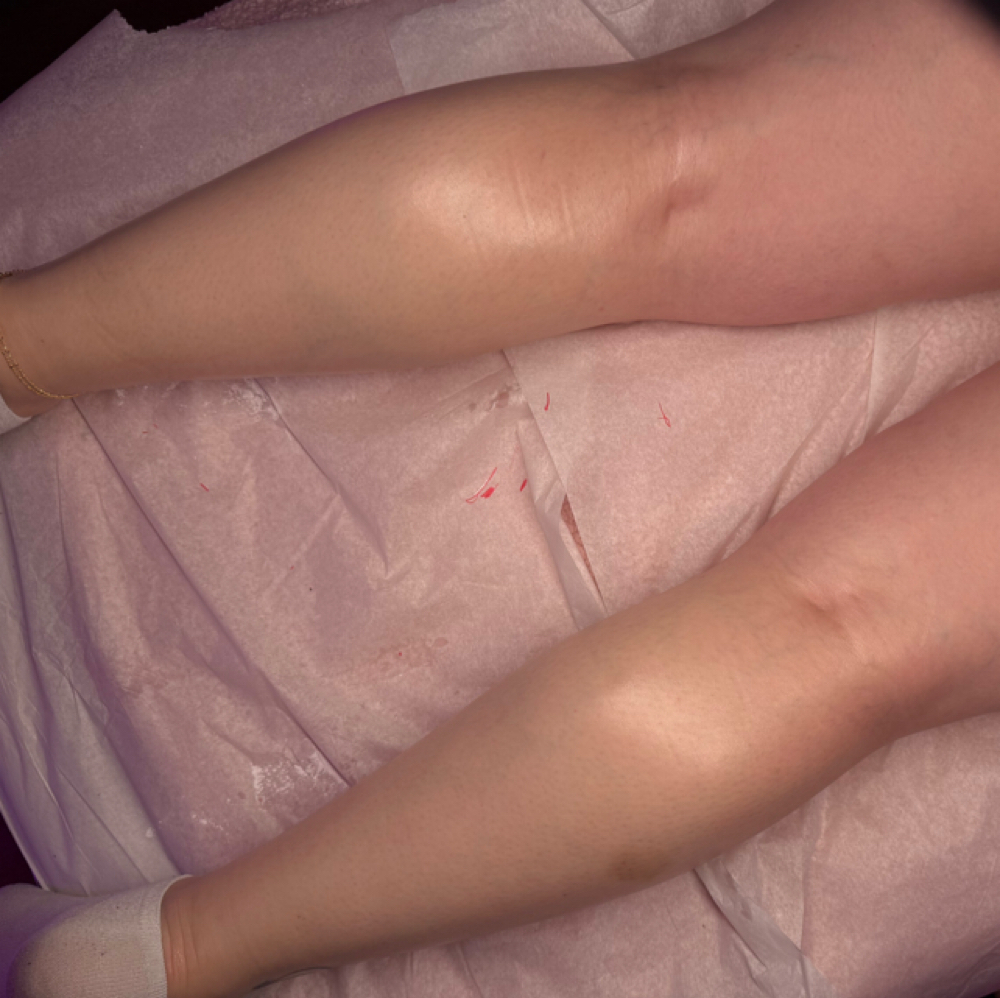 Full-leg Wax at Diverse Esthetics in Depew, NY