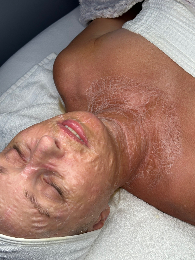 DMK Enzyme Treatment facial