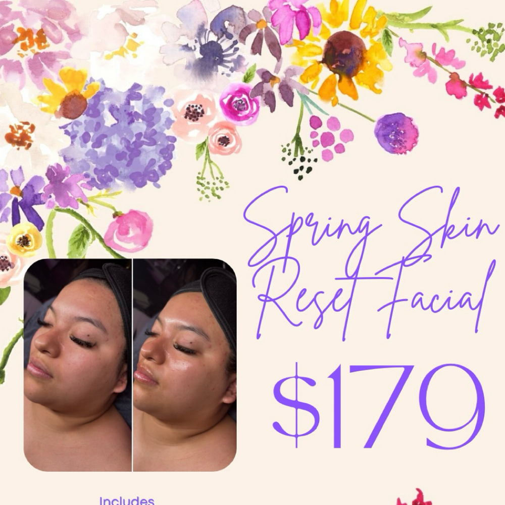 Spring Skin Reset Facial at Sam Elam Esthetics in Meridian, ID