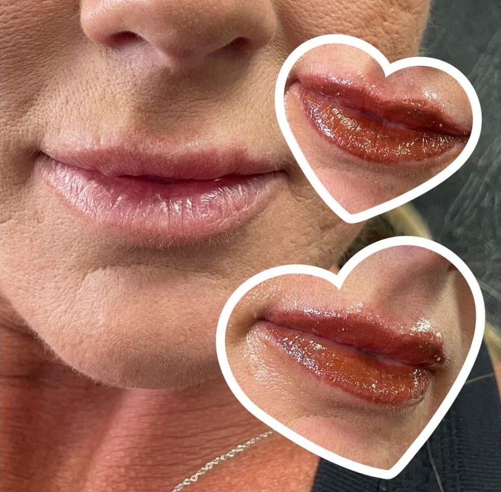 Lips