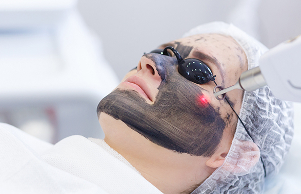 CARBON PEEL - Hollywood Peel