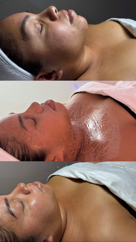 Nú Custom Facial