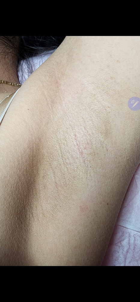 Underarm Wax