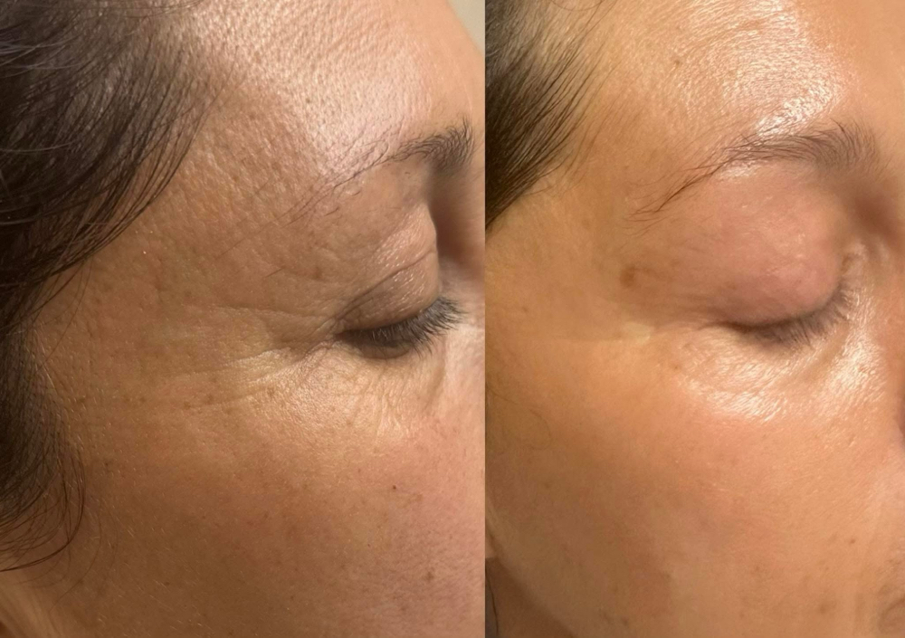 ANTI-AGING FACIAL MULTIVITAMINS