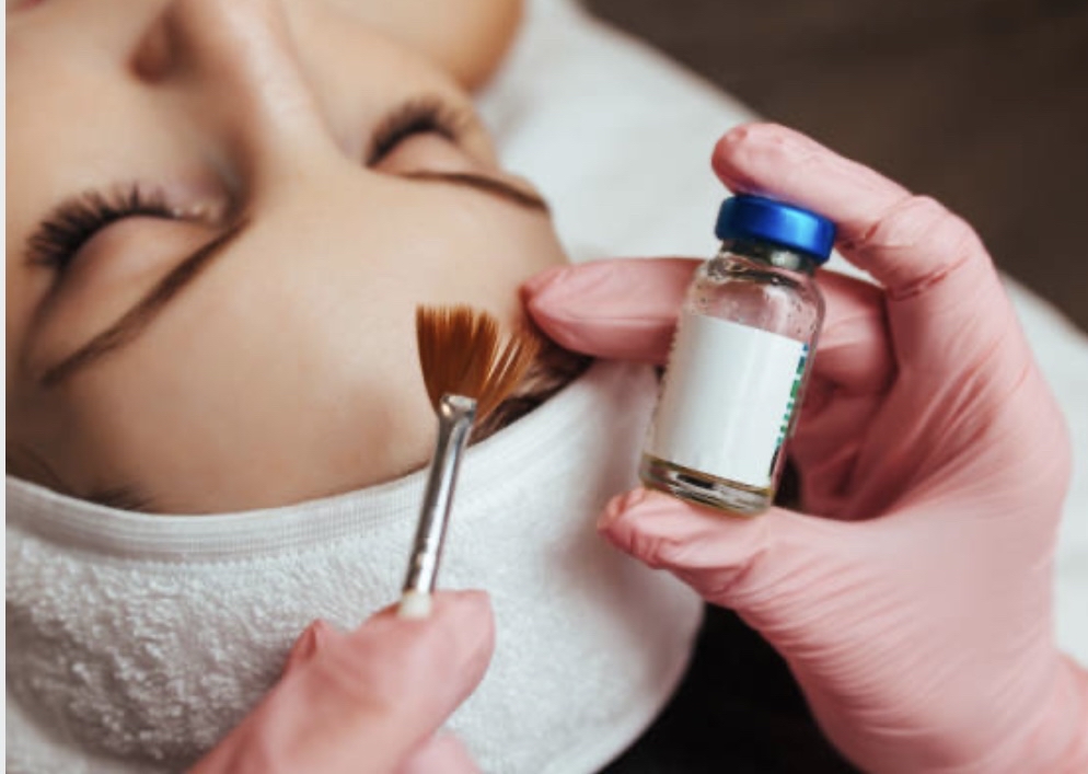 Chemical Peel [Level 1]