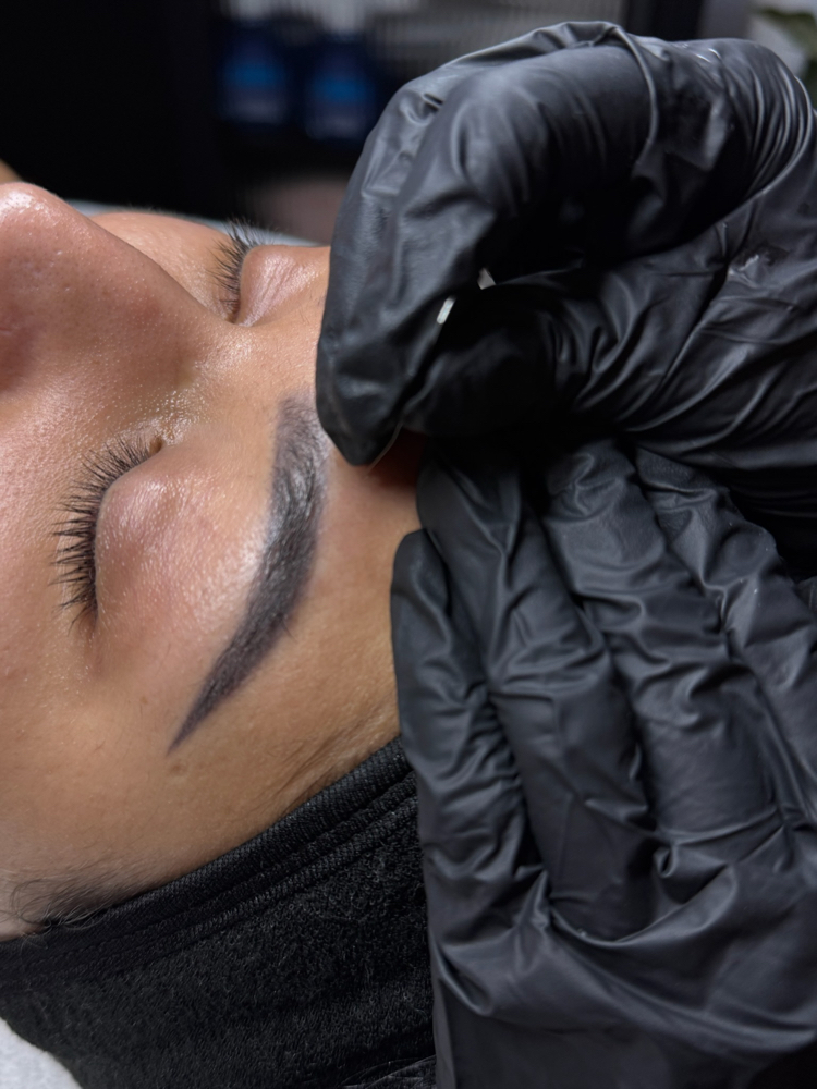 Acne Focused Custom Facial