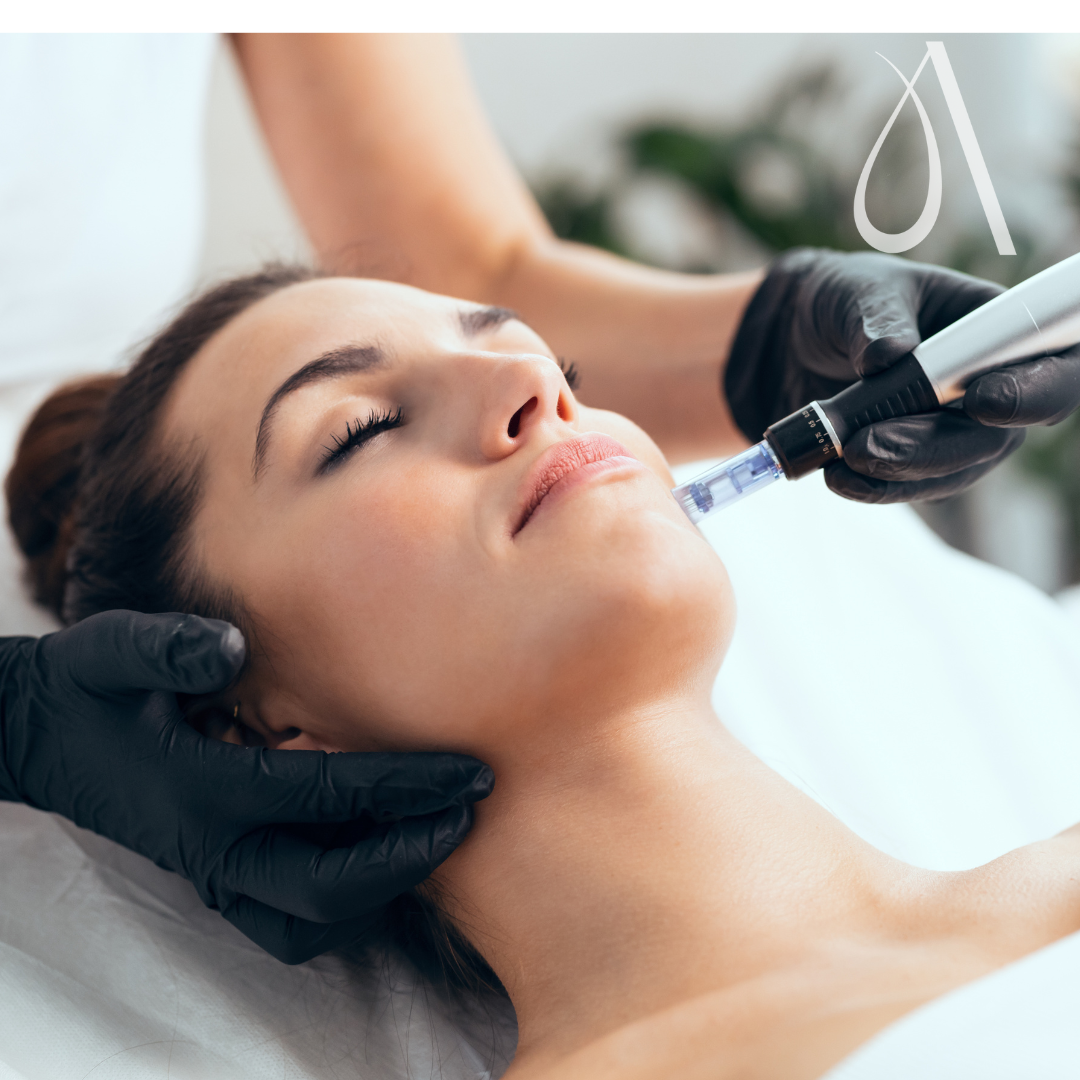 Microneedling at Ambar Aesthetics in Kissimmee, FL
