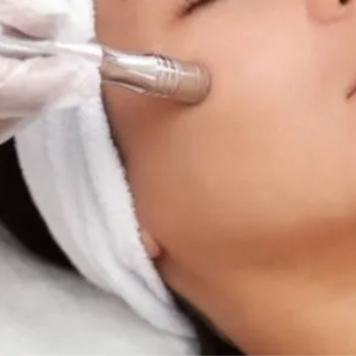 Diamond-Tip Microdermabrasion at Salon Ombre in La Junta, CO