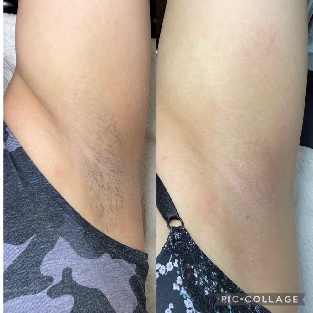 Underarm Wax