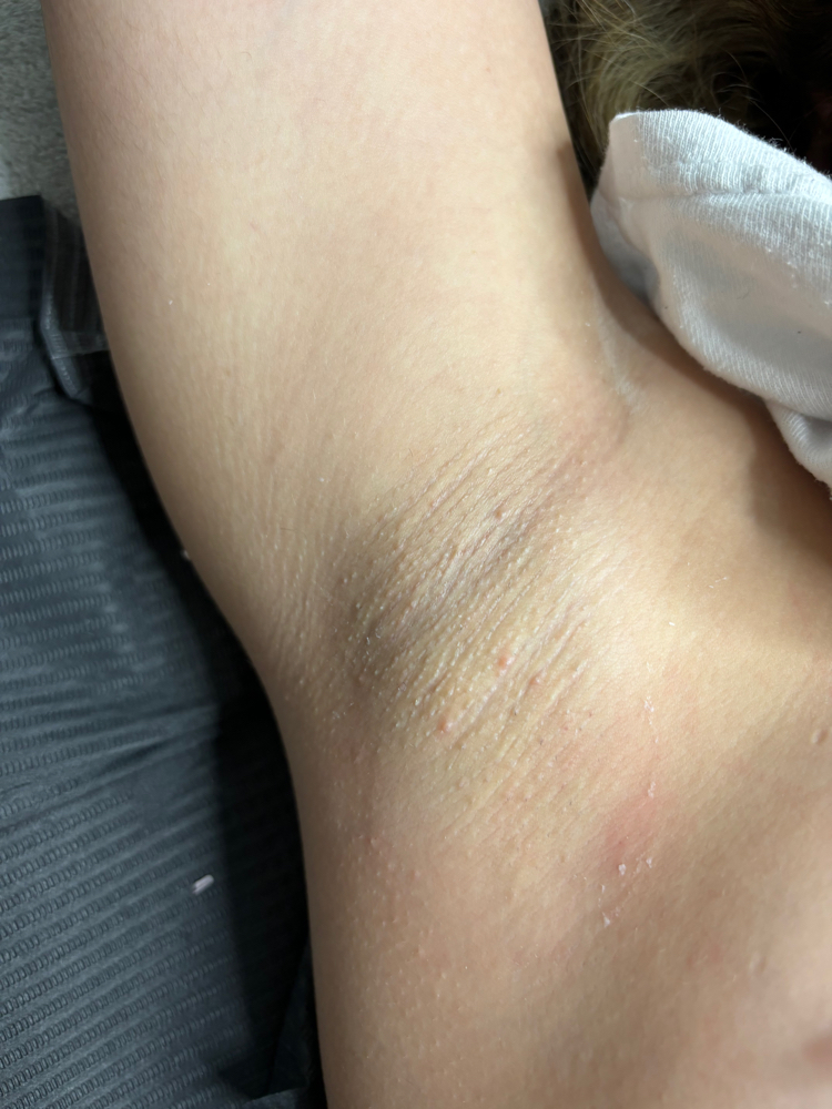 Under Arm wax