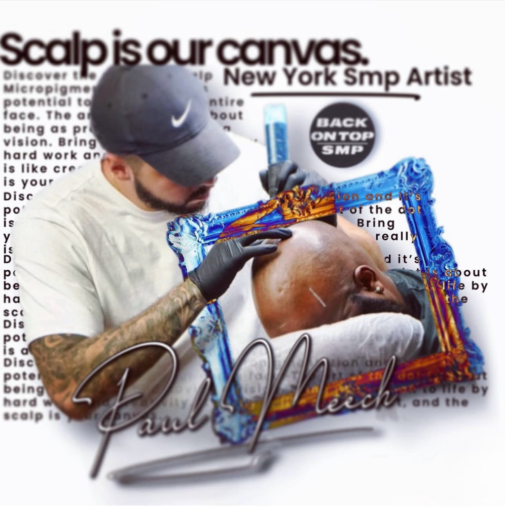 SCALP MICROPIGMENTATION