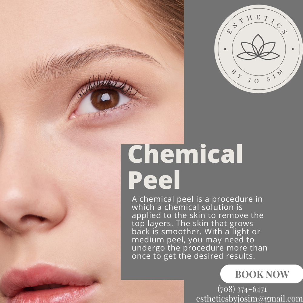 Chemical Peel