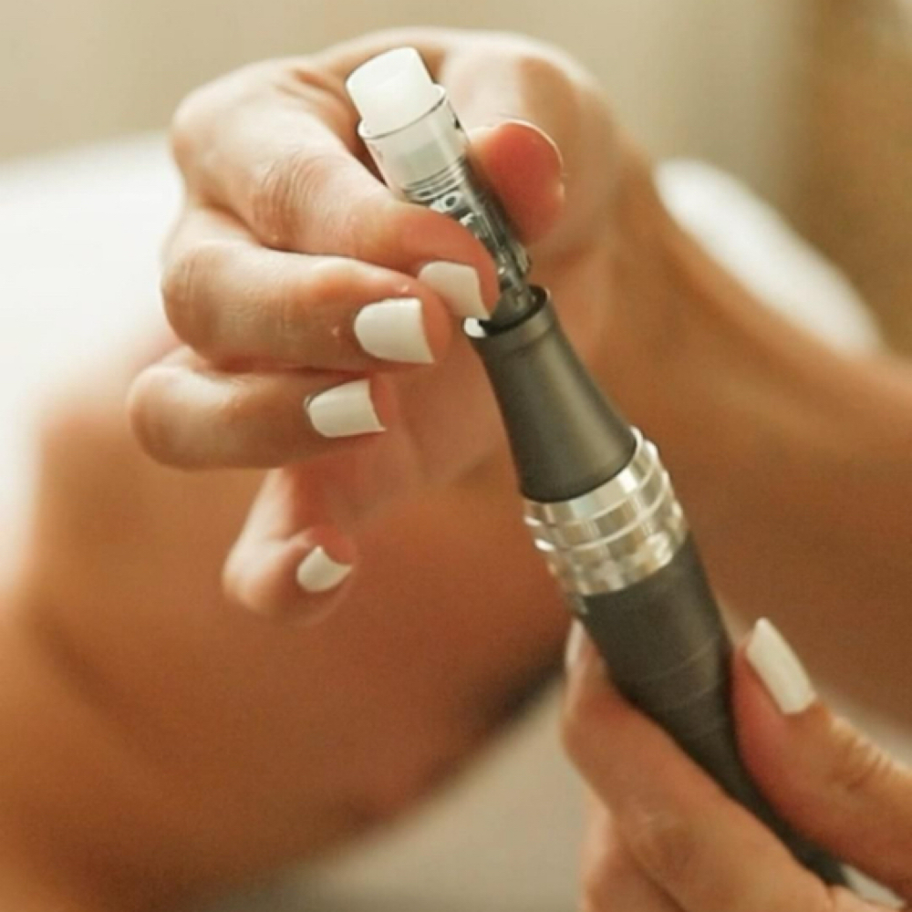 Nano Needling (3 Sessions) at Skin Deep Beauty Spa in Sulphur, LA