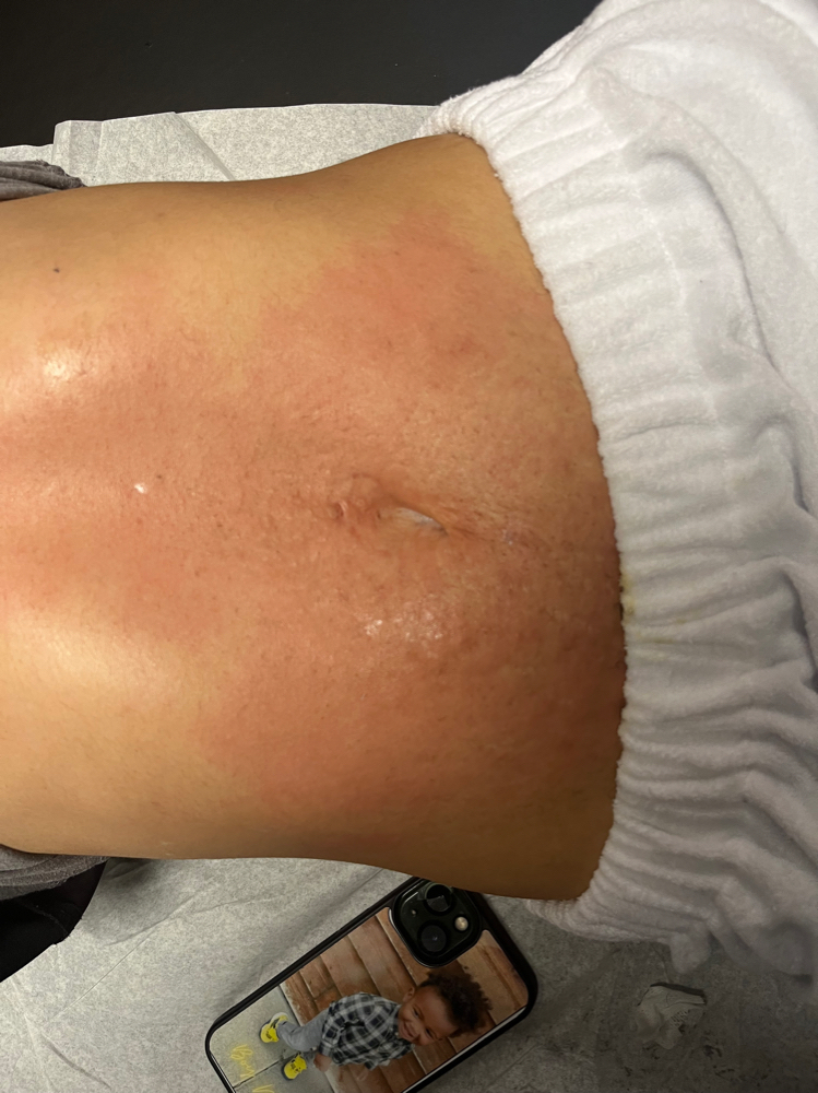 Stomach Wax