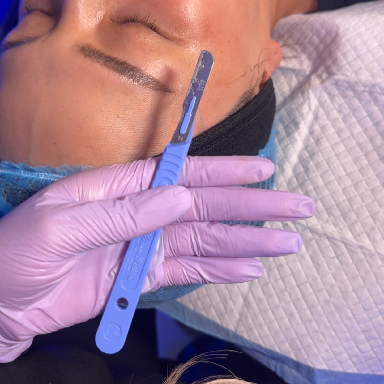 Dermaplaning at Corrective treatments + professional skincare in Atlanta, GA