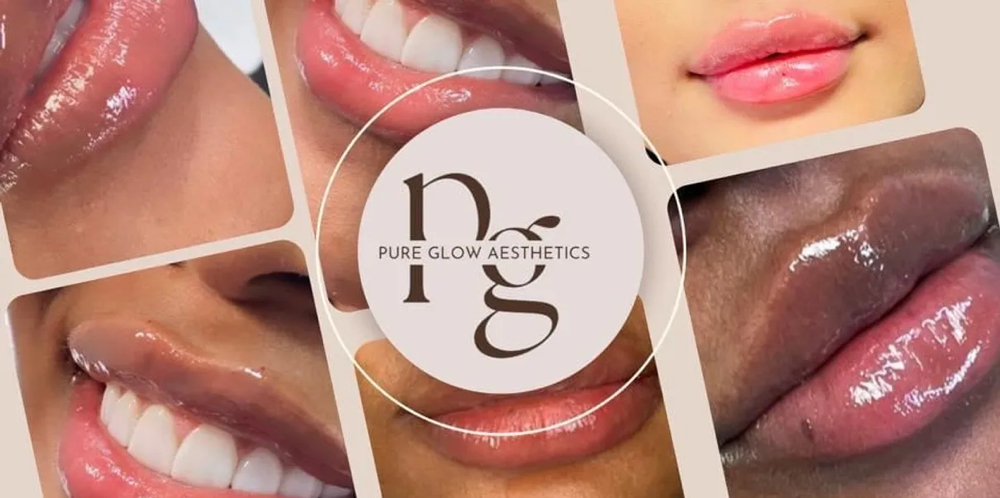 Lip Filler
