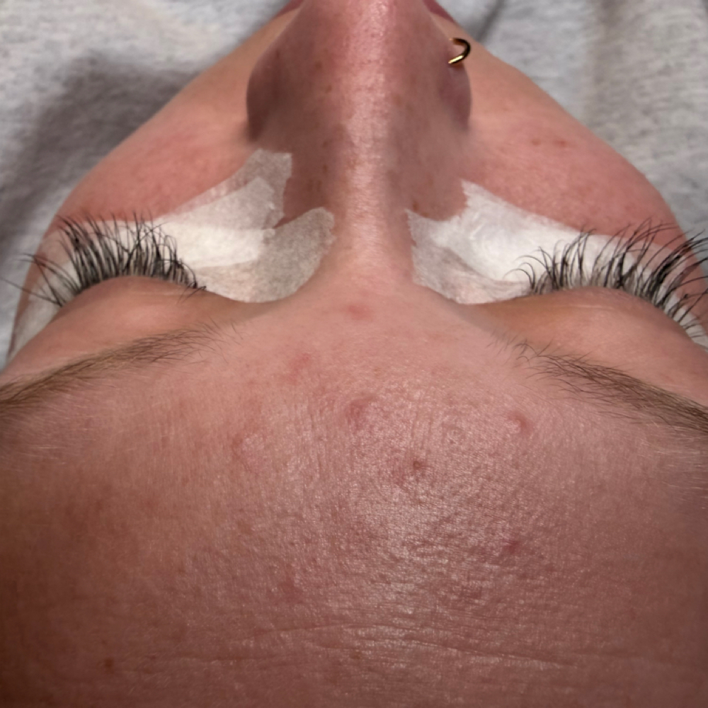 2 week refill at jaesthetics in Baytown, TX