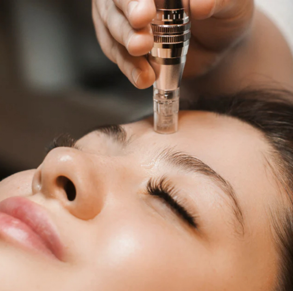 Nano Infusion at The 3D Skin Studio in Marietta, GA