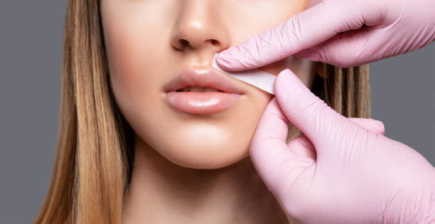 Facial Waxing