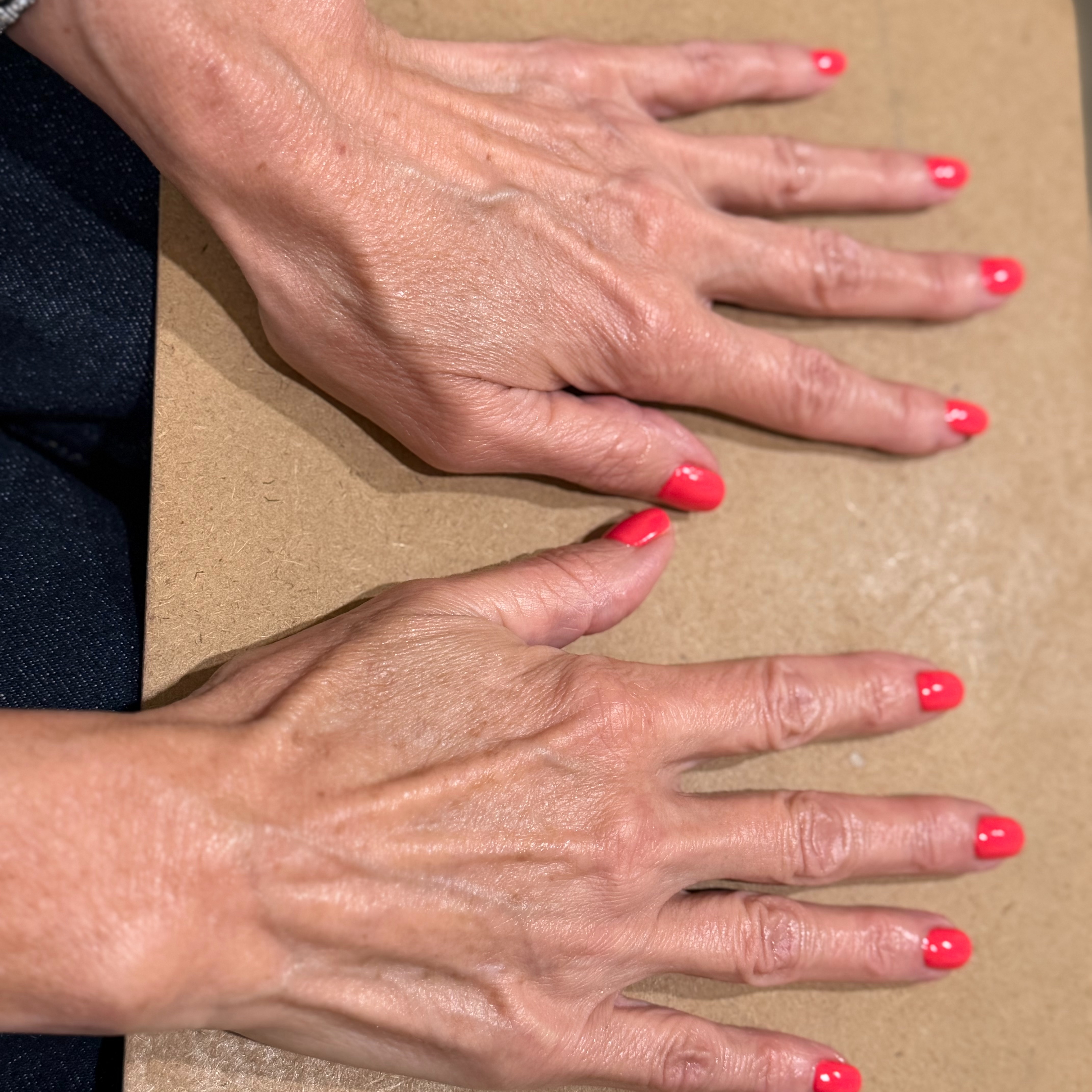 NouvaHands at Revitalize Health in Florence, SC