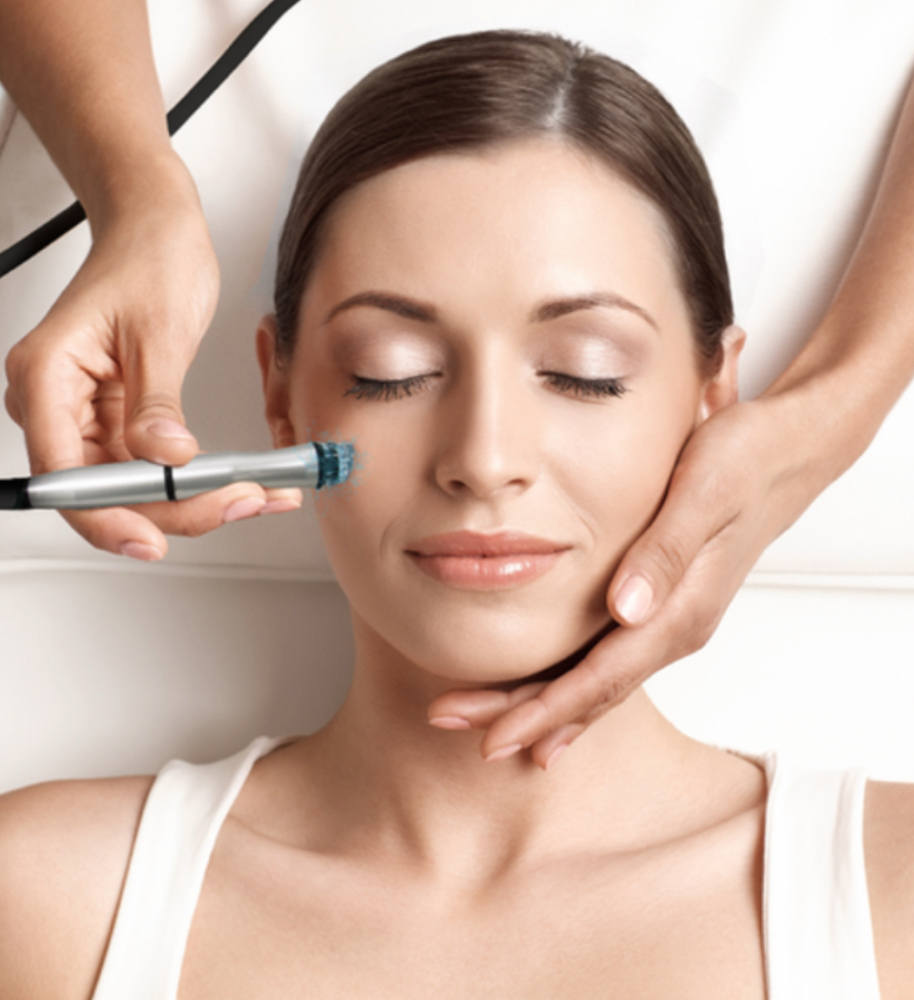 Microdermabrasion