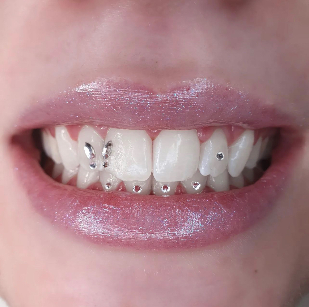 4 Bottom Tooth Gems