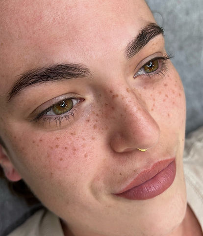 FACE FRECKLES