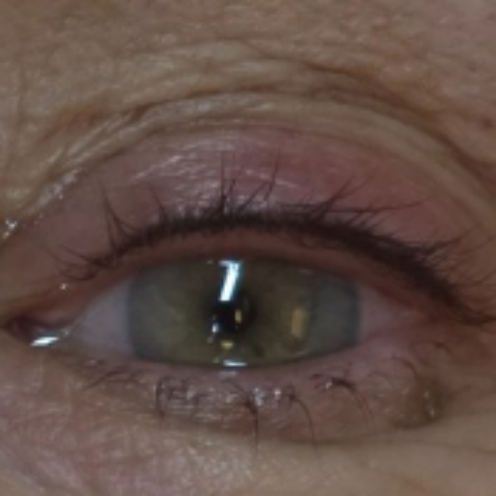 HEALING PROCESS at TrinityRose Ink Boutique Llc in MIlledgeville, GA