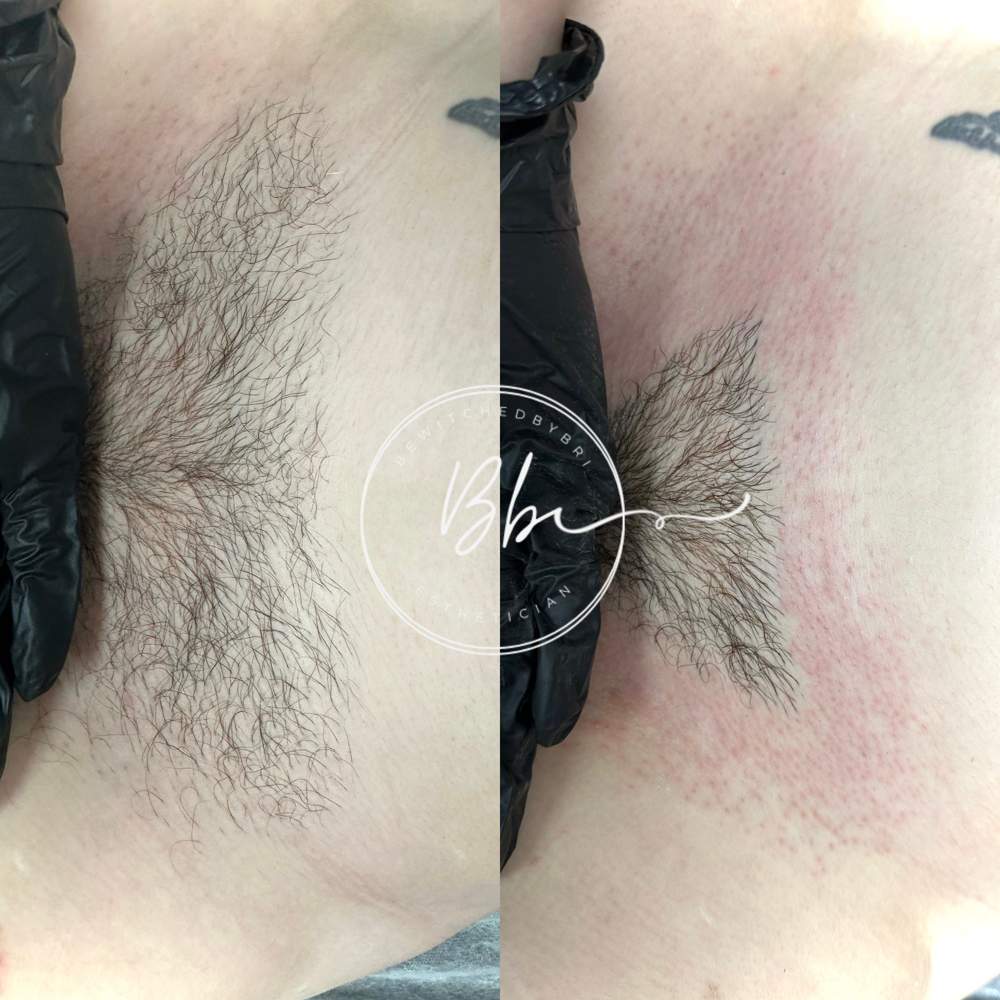 Bikini Wax
