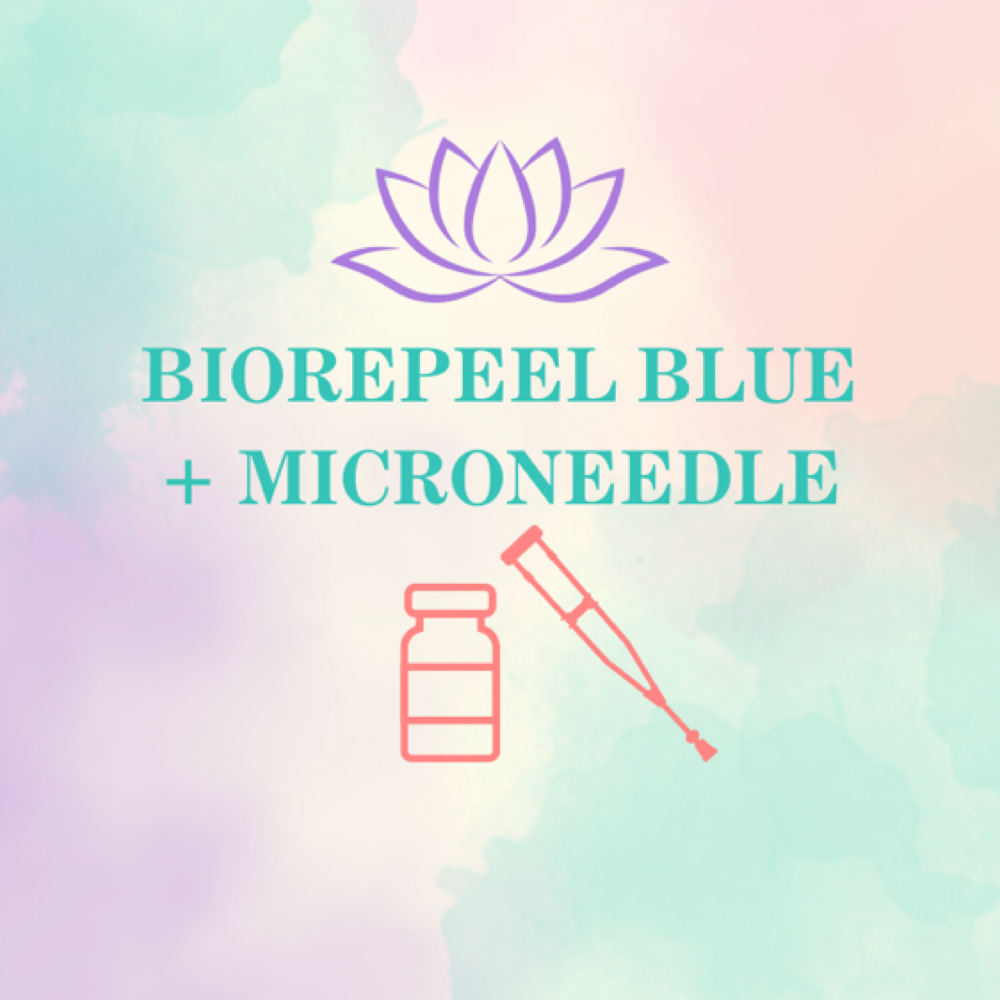 BioRePeel BLUE + Microneedle at Teal Tiger Aesthetics in Delray Beach, FL