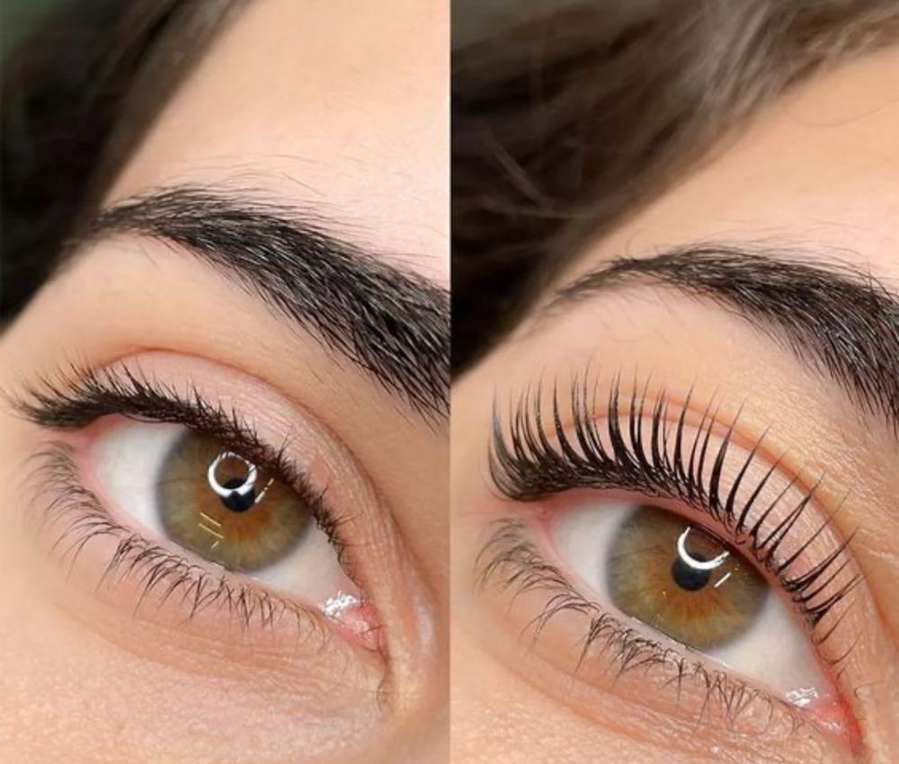Eyelash Lift